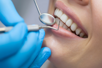 Элайнеры для зубов: как они работают и почему стоит выбрать именно этот способ исправления прикуса