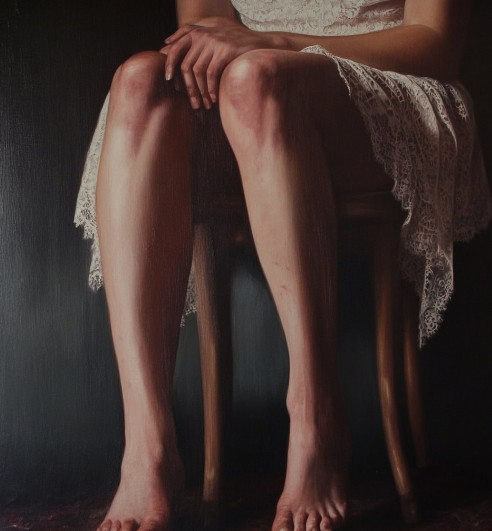 Лечение варикоза: современные методы и рекомендации